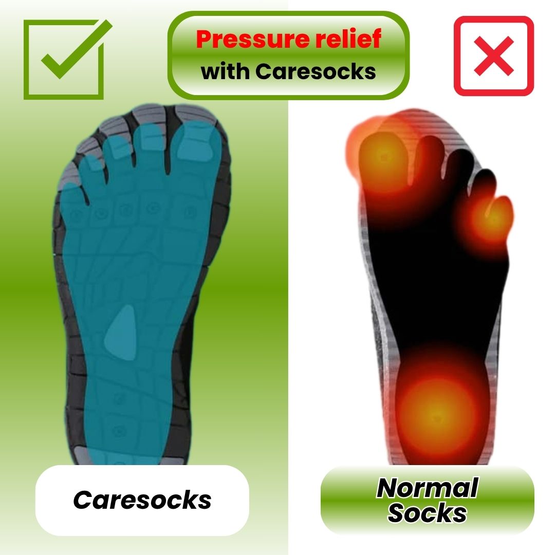 Caresocks - orthopaedic compression stockings - prevents varicose veins & relieves tired feet